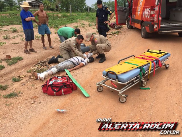 Rolim De Moura Motociclista Sofre Fratura Exposta Em Uma Das Pernas